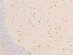 Invitrogen Phospho-Chk1 (Ser317) Polyclonal Antibody 100 &mu;L | Buy Online | Invitrogen&trade; | Fisher Scientific