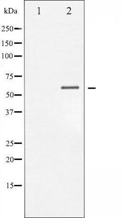 Invitrogen Phospho-Chk1 (Ser317) Polyclonal Antibody 100 &mu;L | Buy Online | Invitrogen&trade; | Fisher Scientific