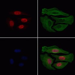 Invitrogen Phospho-HDAC3 (Ser424) Polyclonal Antibody 100 &mu;L; Unconjugated:Antibodies,