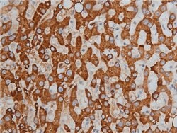 Invitrogen Phospho-HDAC3 (Ser424) Polyclonal Antibody 100 &mu;L; Unconjugated:Antibodies,