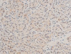 Invitrogen Phospho-TAK1 (Thr187) Polyclonal Antibody 100 &mu;L; Unconjugated:Antibodies,