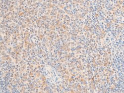 Invitrogen Phospho-TAK1 (Thr187) Polyclonal Antibody 100 &mu;L; Unconjugated:Antibodies,