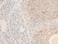 Invitrogen Phospho-TAK1 (Thr187) Polyclonal Antibody 100 &mu;L; Unconjugated:Antibodies,