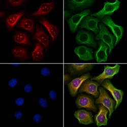 Invitrogen Phospho-JAK2 (Tyr1007) Polyclonal Antibody 100 &mu;L; Unconjugated:Antikörper