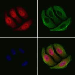 Invitrogen Phospho-Chk2 (Ser516) Polyclonal Antibody 100 &mu;L; Unconjugated:Antibodies,