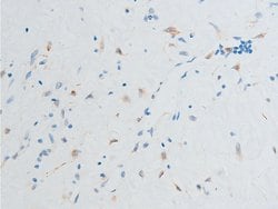 Invitrogen Phospho-Chk2 (Ser516) Polyclonal Antibody 100 &mu;L; Unconjugated:Antibodies,