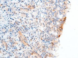 Invitrogen Phospho-Chk2 (Ser516) Polyclonal Antibody 100 &mu;L; Unconjugated:Antibodies,