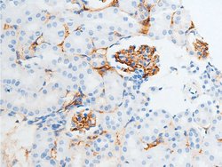 Invitrogen Phospho-Chk2 (Ser516) Polyclonal Antibody 100 &mu;L; Unconjugated:Antibodies,