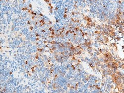 Invitrogen Phospho-Chk2 (Ser516) Polyclonal Antibody 100 &mu;L; Unconjugated:Antibodies,
