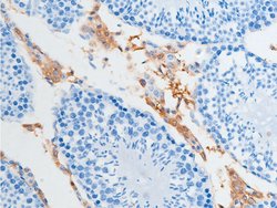 Invitrogen Phospho-Chk2 (Ser516) Polyclonal Antibody 100 &mu;L; Unconjugated:Antibodies,
