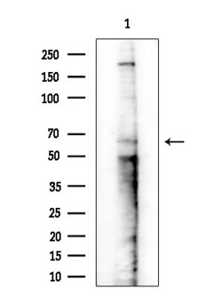 Phospho-Estrogen Receptor alpha (Ser167) Polyclonal Antibody, Invitrogen