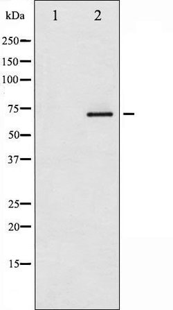 Invitrogen Phospho-Estrogen Receptor alpha (Ser118) Polyclonal Antibody