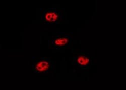 Invitrogen Phospho-p53 (Ser9) Polyclonal Antibody 100 &mu;L; Unconjugated:Antibodies,