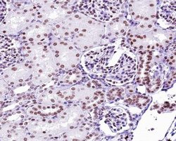 Invitrogen Phospho-p53 (Ser9) Polyclonal Antibody 100 &mu;L; Unconjugated:Antibodies,