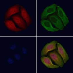 Invitrogen Phospho-p53 (Ser366) Polyclonal Antibody 100 &mu;L | Buy Online | Invitrogen&trade; | Fisher Scientific