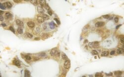 Invitrogen Phospho-p53 (Ser366) Polyclonal Antibody 100 &mu;L | Buy Online | Invitrogen&trade; | Fisher Scientific