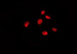 Invitrogen Phospho-p53 (Ser315) Polyclonal Antibody 100 &mu;L; Unconjugated:Antibodies,