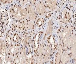 Invitrogen Phospho-p53 (Ser315) Polyclonal Antibody 100 &mu;L; Unconjugated:Antibodies,
