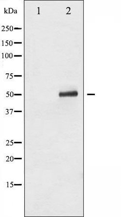 Invitrogen Phospho-p53 (Ser315) Polyclonal Antibody 100 &mu;L; Unconjugated:Antibodies,