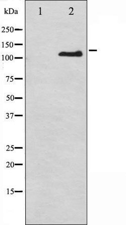 Invitrogen Phospho-CD61 (Tyr785) Polyclonal Antibody 100 &mu;L | Buy Online | Invitrogen&trade; | Fisher Scientific