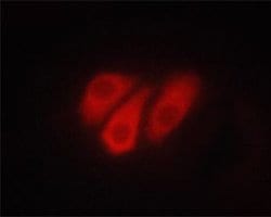 Invitrogen Phospho-ATP1A1 (Ser23) Polyclonal Antibody 100 &mu;L; Unconjugated:Antibodies,