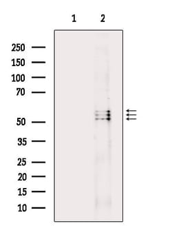 Invitrogen Phospho-Lyn (Tyr508) Polyclonal Antibody 100 &mu;L; Unconjugated:Antibodies,