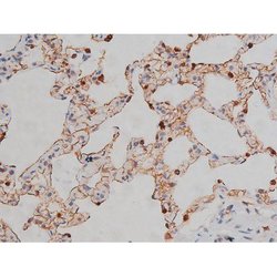 Invitrogen Phospho-Lyn (Tyr508) Polyclonal Antibody 100 &mu;L; Unconjugated:Antibodies,