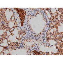 Invitrogen Phospho-Lyn (Tyr508) Polyclonal Antibody 100 &mu;L; Unconjugated:Antibodies,