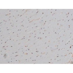 Invitrogen Phospho-Lyn (Tyr508) Polyclonal Antibody 100 &mu;L; Unconjugated:Antibodies,