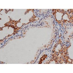Invitrogen Phospho-Lyn (Tyr508) Polyclonal Antibody 100 &mu;L; Unconjugated:Antibodies,