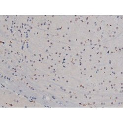 Invitrogen Phospho-Lyn (Tyr508) Polyclonal Antibody 100 &mu;L; Unconjugated:Antibodies,