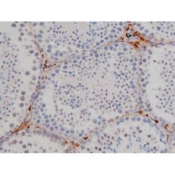 Invitrogen Phospho-Lyn (Tyr508) Polyclonal Antibody 100 &mu;L; Unconjugated:Antibodies,