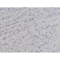 Invitrogen Phospho-Lyn (Tyr508) Polyclonal Antibody 100 &mu;L; Unconjugated:Antibodies,
