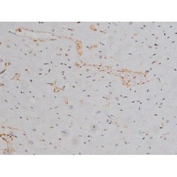 Invitrogen Phospho-Lyn (Tyr508) Polyclonal Antibody 100 &mu;L; Unconjugated:Antibodies,