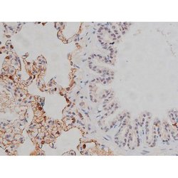 Invitrogen Phospho-Lyn (Tyr508) Polyclonal Antibody 100 &mu;L; Unconjugated:Antibodies,