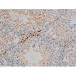 Invitrogen Phospho-BCL-2 (Ser70) Polyclonal Antibody 100 &mu;L; Unconjugated:Antibodies,