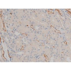 Invitrogen Phospho-BCL-2 (Ser70) Polyclonal Antibody 100 &mu;L; Unconjugated:Antibodies,