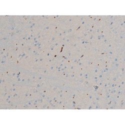 Invitrogen Phospho-BCL-2 (Ser70) Polyclonal Antibody 100 &mu;L; Unconjugated:Antibodies,