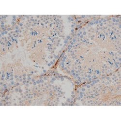 Invitrogen Phospho-BCL-2 (Ser70) Polyclonal Antibody 100 &mu;L; Unconjugated:Antibodies,
