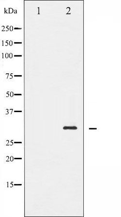 Invitrogen Phospho-BCL-2 (Ser70) Polyclonal Antibody 100 &mu;L; Unconjugated:Antibodies,