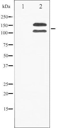 Invitrogen Phospho-FGFR1 (Tyr154) Polyclonal Antibody 100 &mu;L; Unconjugated:Antibodies,
