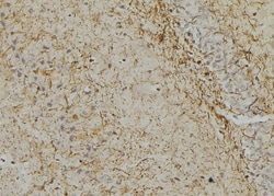Invitrogen Phospho-GFAP (Ser38) Polyclonal Antibody 100 &mu;L | Buy Online | Invitrogen&trade; | Fisher Scientific