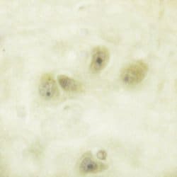 Invitrogen Phospho-GFAP (Ser38) Polyclonal Antibody 100 &mu;L | Buy Online | Invitrogen&trade; | Fisher Scientific