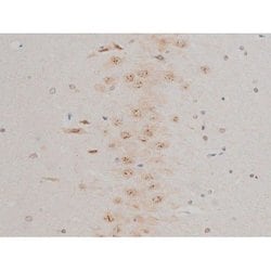 Invitrogen Phospho-GFAP (Ser38) Polyclonal Antibody 100 &mu;L | Buy Online | Invitrogen&trade; | Fisher Scientific