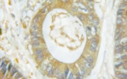 Invitrogen Phospho-p47phox (Ser359) Polyclonal Antibody 100 &mu;L | Buy Online | Invitrogen&trade; | Fisher Scientific