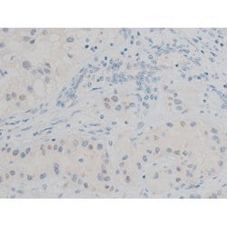 Invitrogen Phospho-GATA1 (Ser142) Polyclonal Antibody 100 &mu;L; Unconjugated:Antibodies,
