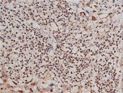 Invitrogen Phospho-VEGF Receptor 1 (Tyr1213) Polyclonal Antibody 100 &mu;L | Buy Online | Invitrogen&trade; | Fisher Scientific