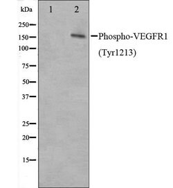 Invitrogen Phospho-VEGF Receptor 1 (Tyr1213) Polyclonal Antibody 100 &mu;L | Buy Online | Invitrogen&trade; | Fisher Scientific