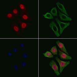 Invitrogen Phospho-NFkB p105/p50 (Ser907) Polyclonal Antibody 100 &mu;L;