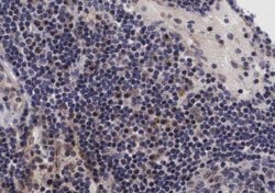 Invitrogen Phospho-NFkB p105/p50 (Ser907) Polyclonal Antibody 100 &mu;L;